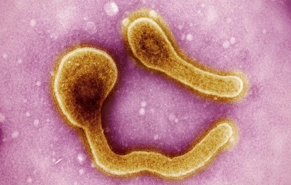 Marburg virus: વિશ્વના સૌથી ખતરનાક વાયરસ મારબર્ગને કારણે 12 થી વધુ લોકોના મોત, જાણો તેના લક્ષણો