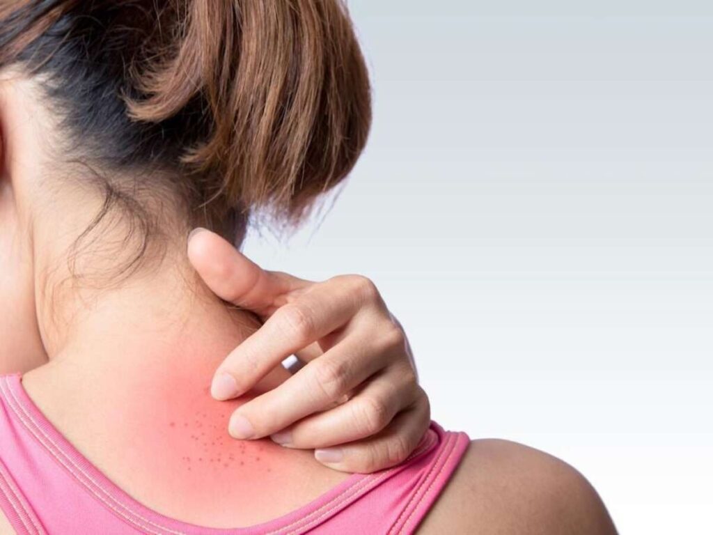 Itching: મચ્છર કરડ્યા પછી કેમ ન ખંજવાળવું જોઈએ? વૈજ્ઞાનિકોએ શોધી કાઢ્યું અસલી કારણ